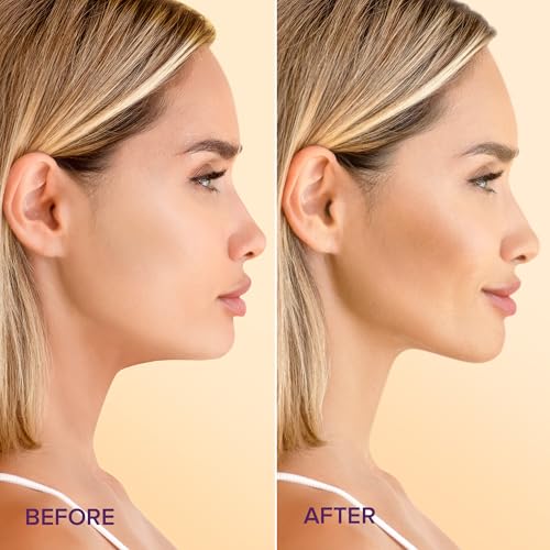MAREE V Line Lifting Mask with 24K Gold – Deep Collagen Face Mask for Women – Jawline Shaper Mask with Retinol & Hyaluronic Acid – Neck Tightening & Firming - Double Chin Strap for Face Lift