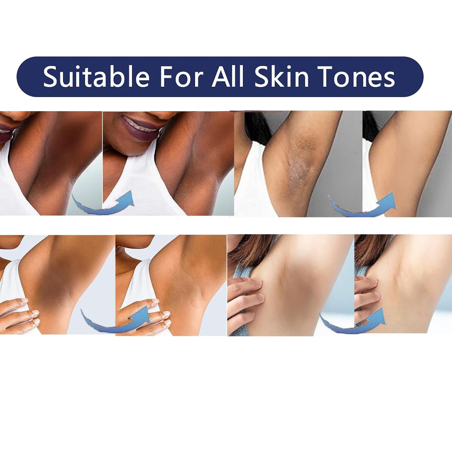 Skin Lightening Cream Gel For Body Intimate Area With Niacinamide, Arbutin, Vitamin C For Private Parts, Underarm, Knees, Elbows, Inner Thigh, Bikini Areas, armpit Skin Whitening Bleaching Cream 30ML
