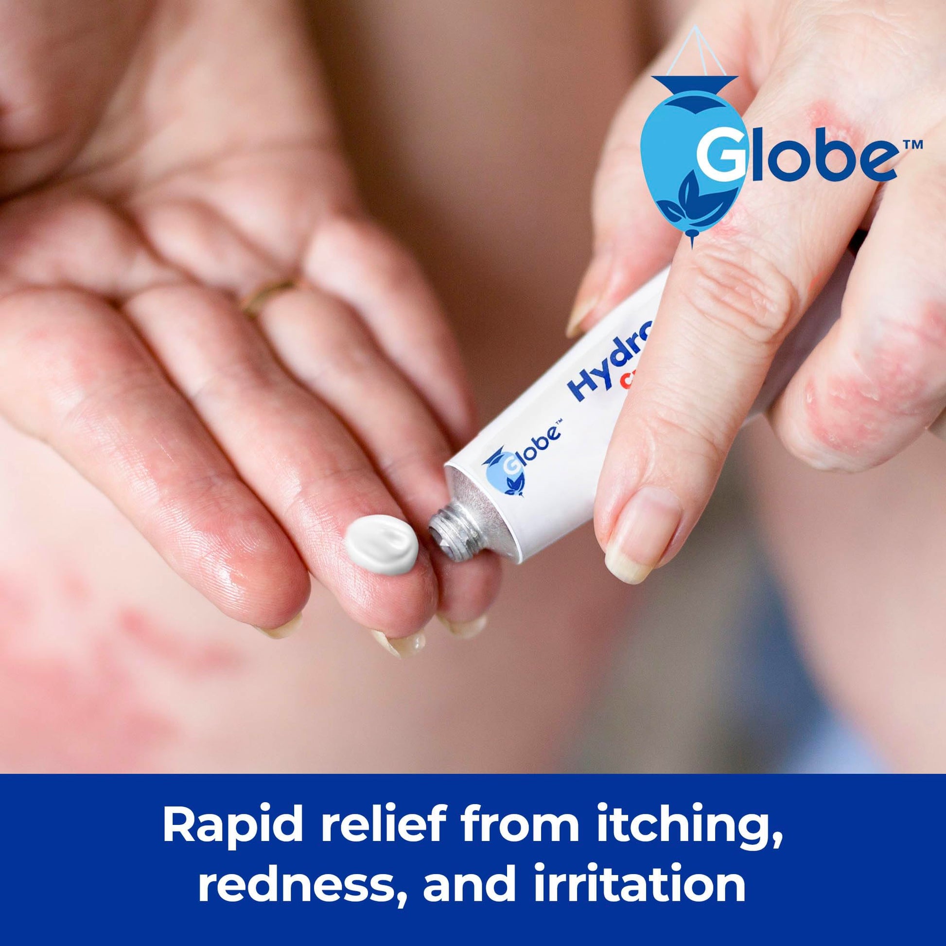 Globe (4 Pack) Hydrocortisone Maximum Strength Anti-Itch Cream 1% w/Aloe, Intensive Formula for Redness, Rash, Bug & Mosquito Bites, Eczema, Hemorrhoids, Sensitive Skin, Instant Itch Relief,1 oz Tube