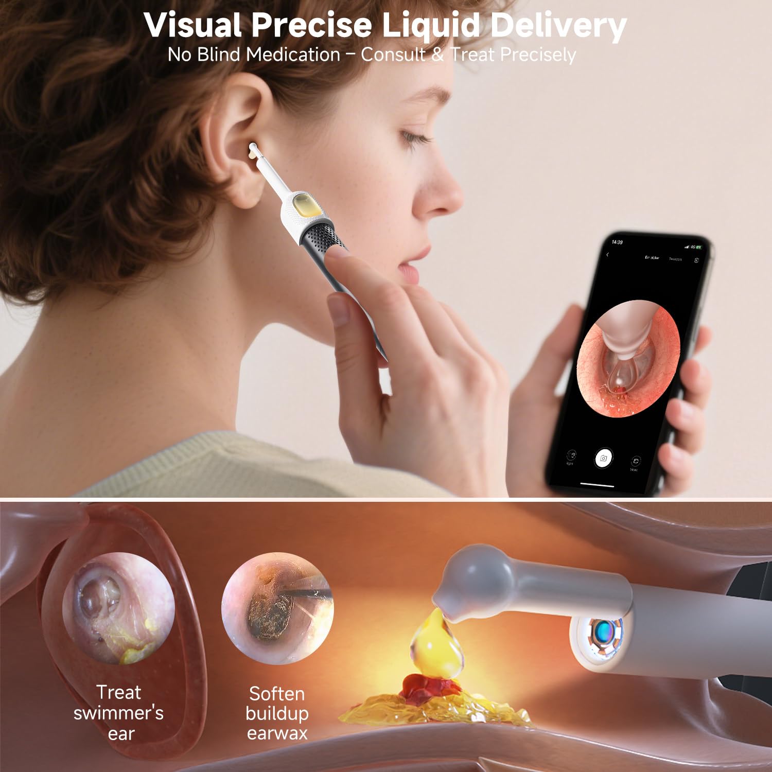 BEBIRD R1 Ultra Ear Wax Removal, Ear Cleaner with Camera Ear Scope, Wax Remove Ear Pick with Ear Otoscope Tweezers, Visual Dropper Cleaning Kit, Ear/Nose/Throat Examination Tool with Light for Family