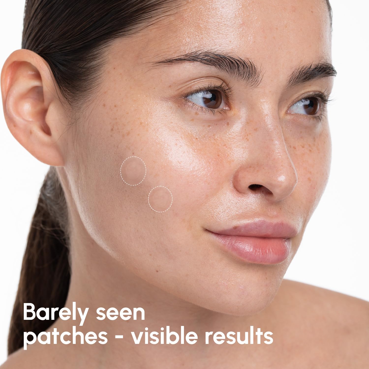 MAREE Pimple Patches for Face - Acne Clearing Device - Clear Acne Patches for Face - Invisible Hydrocolloid Patch Parches Para Acne Stickers Zit Dots - Cystic Zit Healing Blemish Pinple Covers