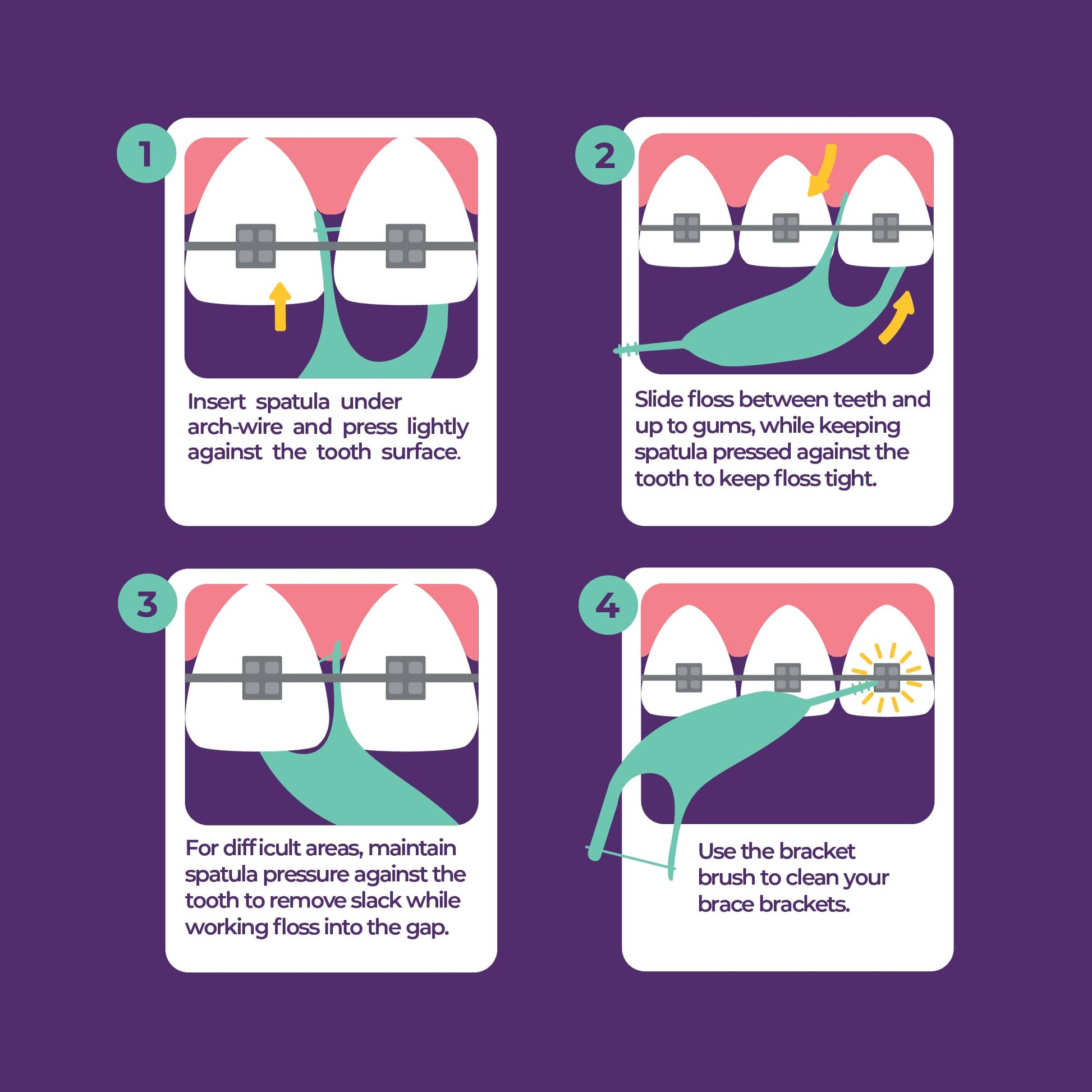 Platypus Orthodontic Flossers for Braces, 40 Count (Pack of 1), Ortho Picks for Adults & Kids, Fits Under Arch Wire, Non-Damaging, Encourage Flossing Habits