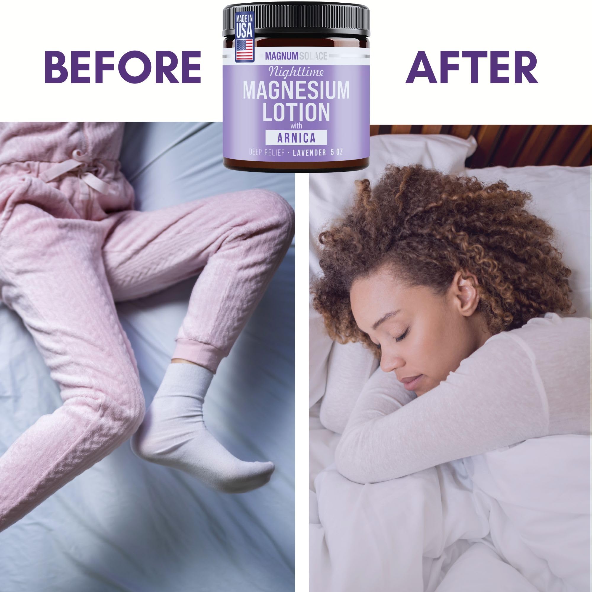 Nighttime Magnesium Lotion with Arnica – Soothing Relief & Relaxation, Highly Concentrated Magnesium for Muscles & Joints – Apply to Legs or Feet Before Bed – Skin-Friendly