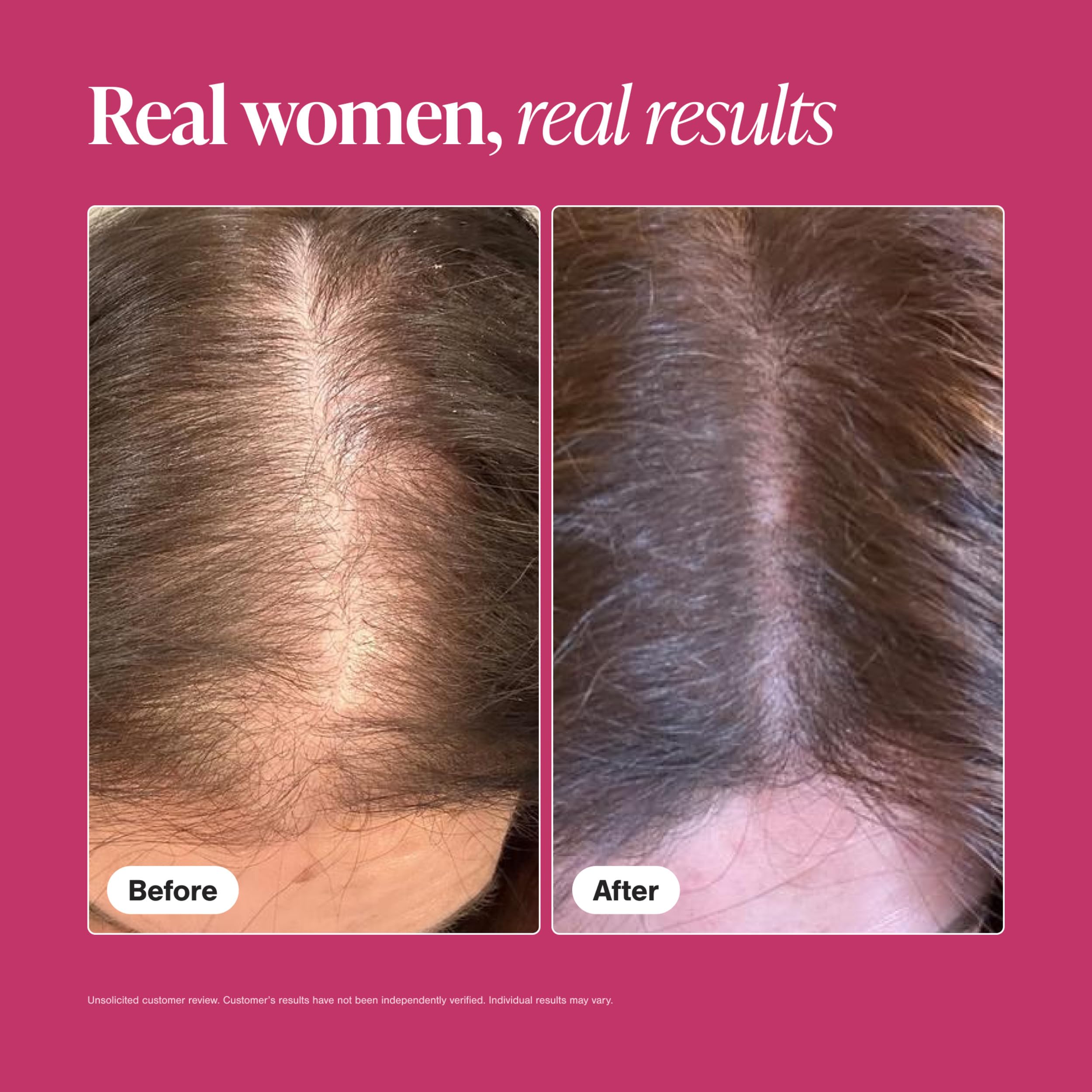 Viviscal Hair Growth Supplements For Women For Thicker, Fuller Hair, Nourishes Thinning & Loss, With Proprietary Collagen Complex, 60 Tablets, 1 Month Supply