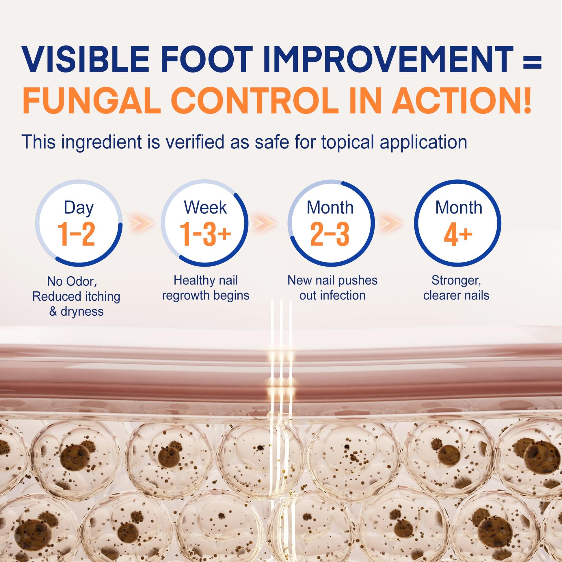 Toenail Fungus Treatment with 25% Undecylenic Acid: Toenail Fungus Treatment Extra Strength for Thick, Yellow and Damaged Nails - Safe and Gentle for Nails Care