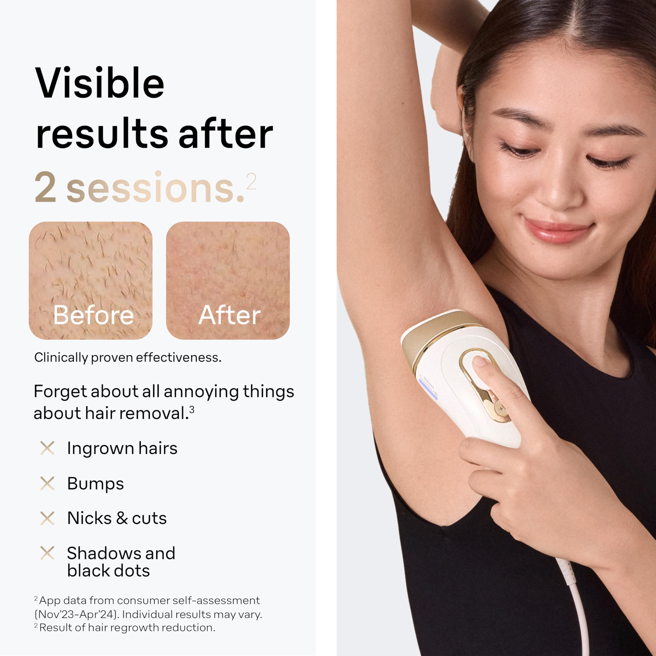 Braun Smart IPL, Silk·Expert Pro 5: at Home Laser Hair Removal for Women and Men, Permanent Visible Hair Reduction in Hair Regrowth for Body & Face, with Venus Swirl Razor, Corded, IPL5137