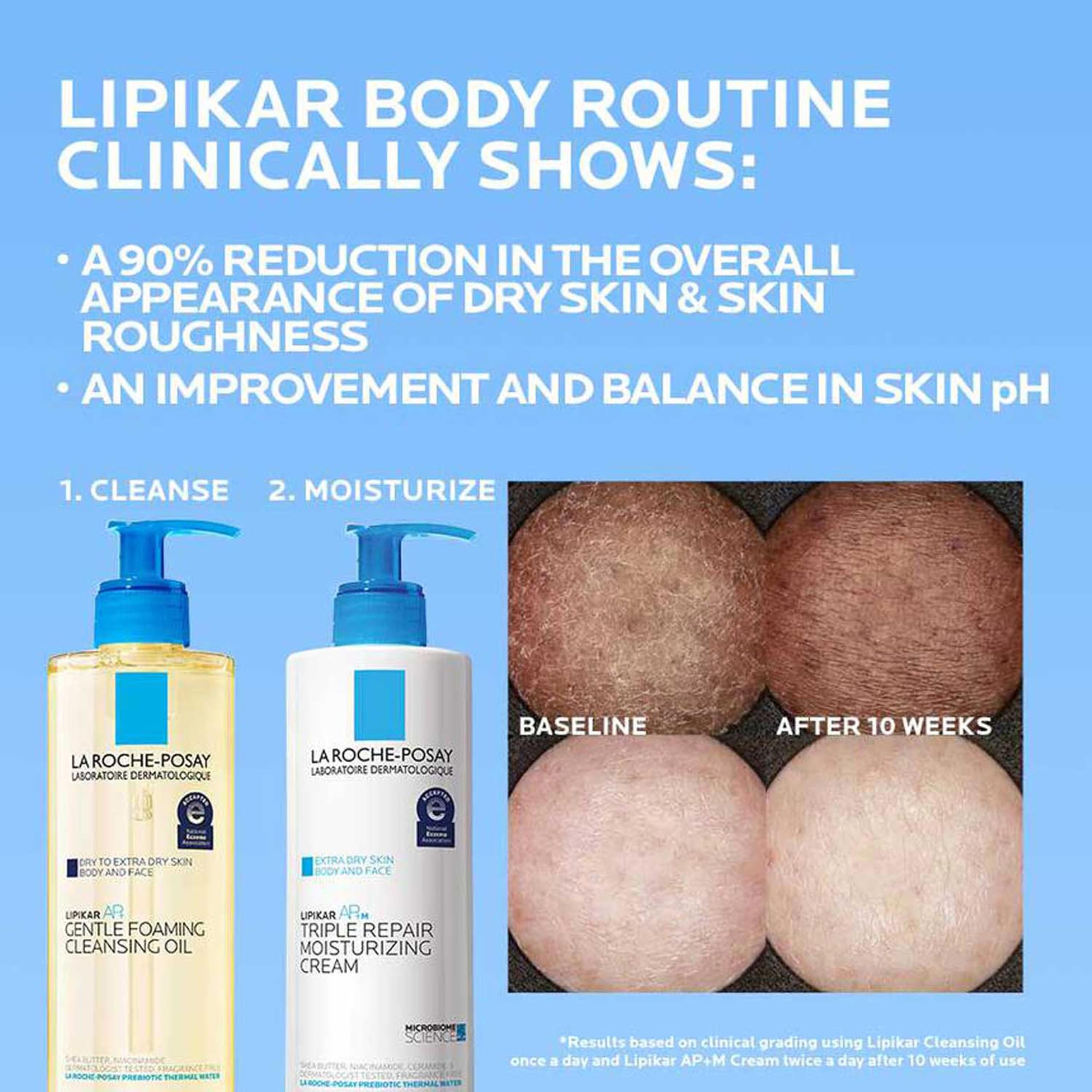 La Roche-Posay Lipikar AP+ Triple Repair Moisturizing Cream, Face & Body Lotion For Dry Skin, Shea Butter & Niacinamide Moisturizer, Gentle Face & Body Cream For Dry, Rough & Sensitive Skin