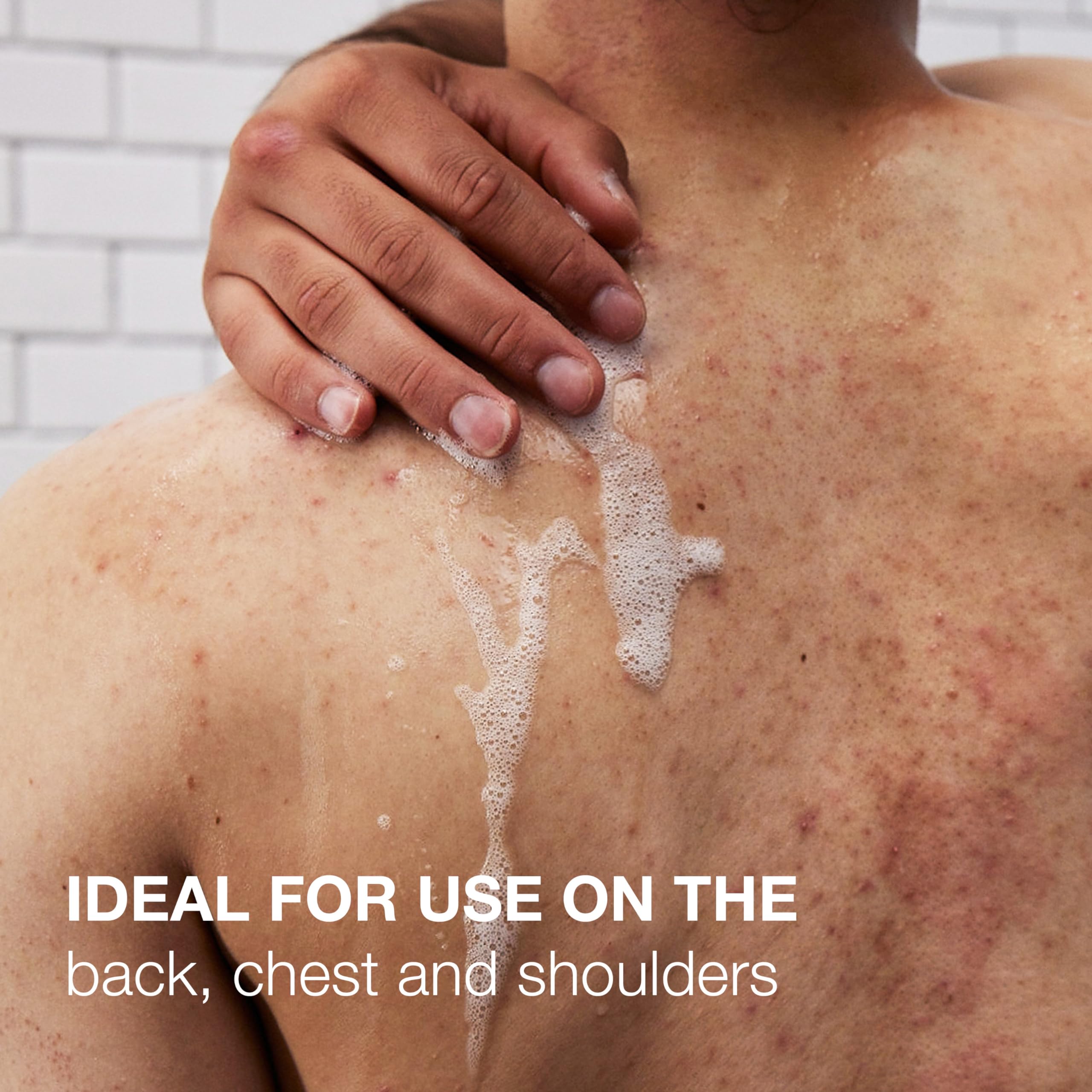 Neutrogena Salicylic Acid & PHA Stubborn Acne Body Wash, Exfoliating Cleanser Acne Treatment for Chest & Shoulder, Gently Clears, Exfoliates & Helps Prevent Breakouts, Fragrance Free, 8.5 Fl Oz