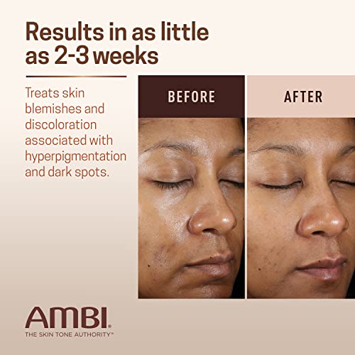 Ambi Even & Clear Advanced Fade Cream, Hydroquinone-free, Hyperpigmentation Treatment, Stubborn Dark Spot Corrector, Results In As Little As 2-3 Weeks, Niacinamide, Licorice Root Extract, PHA, 1 Fl Oz