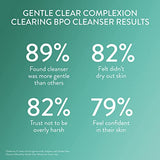 Cetaphil Gentle Clear Complexion-Clearing BPO Acne Cleanser with 2.6% Benzoyl Peroxide, Creamy and Soothing for Sensitive Skin, Suitable for All Skin Types, 4.2oz