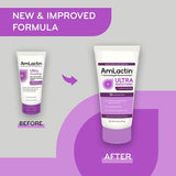 AmLactin Ultra Smoothing - 4.9 oz Body & Hand Cream with 15% Lactic Acid - Exfoliator and Moisturizer for Rough and Bumpy Dry Skin (Packaging May Vary)