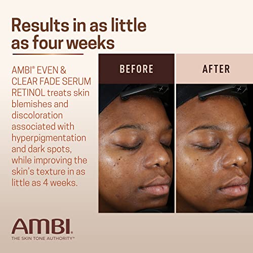 Ambi Even & Clear Fade Serum, Hyperpigmentation Treatment, Hydroquinone-free, Dark Spot Corrector, Results In As Little As 4 Weeks, Retinol, Hyaluronic Acid, Niacinamide, Ceramides, 1 Fl Oz